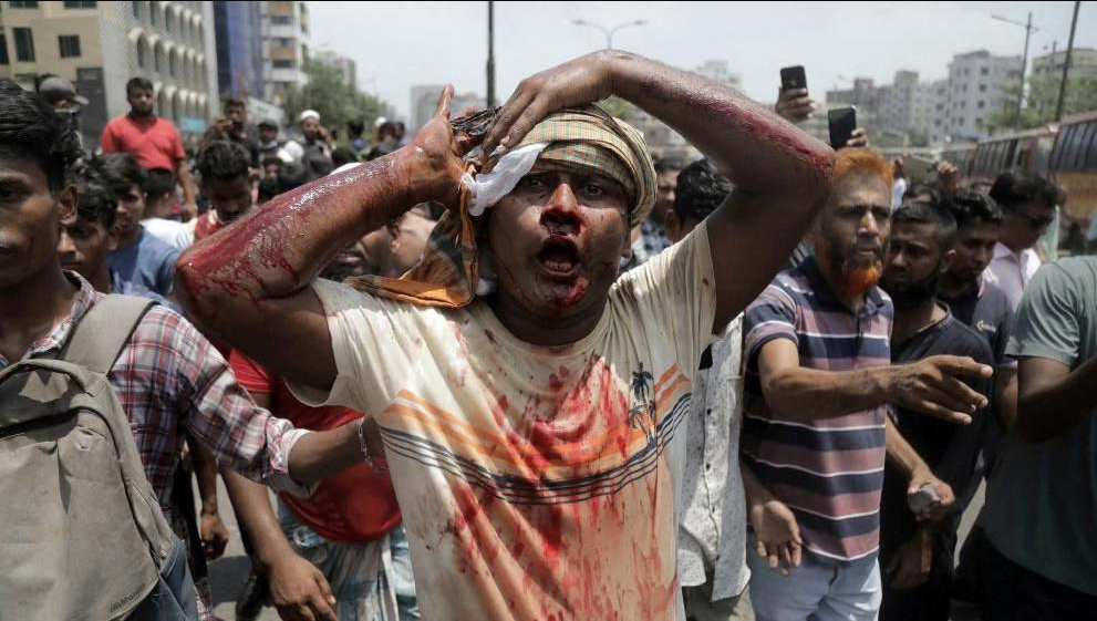 A bloodied protester walks through a crowd during the 2024 Bangladesh uprising